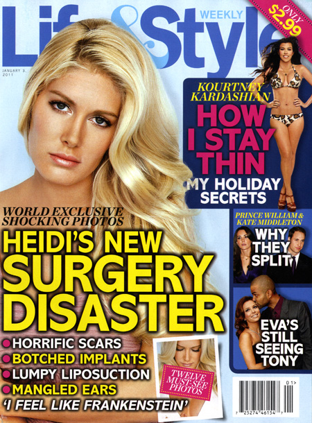 heidi montag surgery gone wrong. heidi montag surgery disaster.
